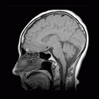 SMART DICOM SMART DICOM